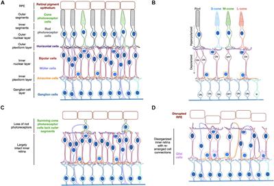 Optogenetic Gene Therapy for the Degenerate Retina: Recent Advances